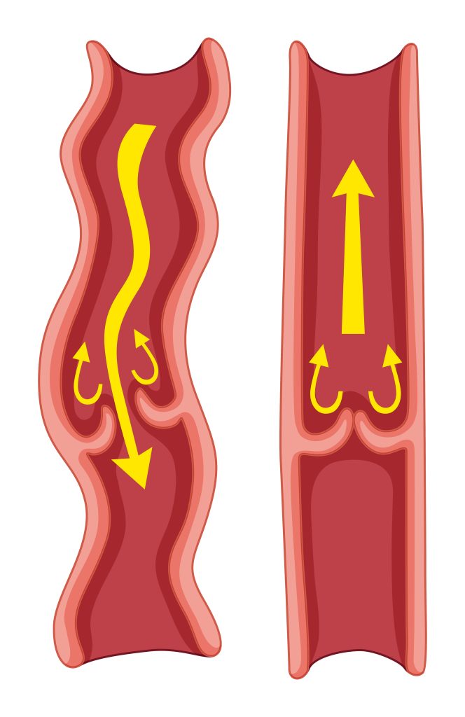 medical diagram of valve mechanism in veins showing blood flow. 